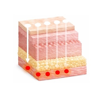STEP1 深い層のリフトアップ